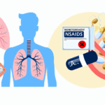 Nsaid alerjisi ilac alerjileri