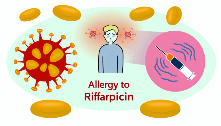 Rifampisin alerjisi ilac alerjileri