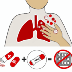 Tuberkuloz ilaci alerjisi ilac alerjileri
