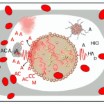 Ace İnhibitörü alerjisi İlaç alerjileri