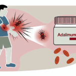 Adalimumab alerjisi İlaç alerjileri