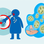 Aureobasidium alerjisi solunum (İnhalasyon) alerjileri