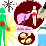 Diüretik alerjisi İlaç alerjileri