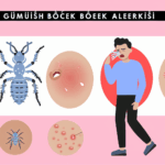 Gümüş böcek alerjisi böcek alerjileri