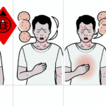 Sentetik kumaş alerjisi temas (kontakt) alerjileri