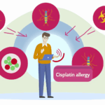 Sisplatin alerjisi İlaç alerjileri