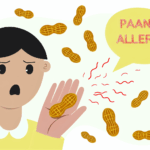 Un biti alerjisi besin alerjileri