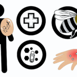 Bal arısı alerjisi böcek alerjileri