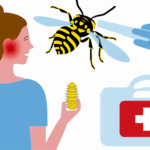 Trichogramma arısı alerjisi böcek alerjileri